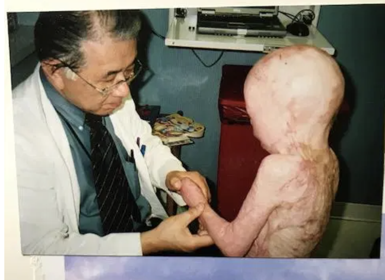 Cậu bé từng bị bỏng 95% cơ thể, trải qua 87 cuộc phẫu thuật đau đớn, bị gọi là người ngoài hành tinh bây giờ ra sao sau nhiều năm? - Ảnh 4.