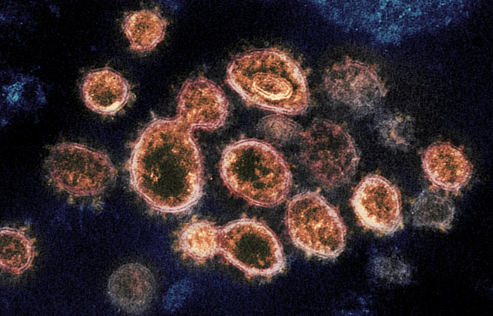 Nghiên cứu hé lộ phạm vi ảnh hưởng đến não của virus SARS-CoV-2 - Ảnh 1.
