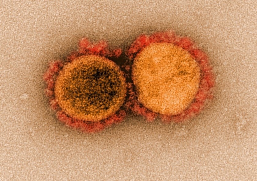 Kịch bản ác mộng về tác động của biến chủng virus mới phát hiện ở California - Ảnh 1.