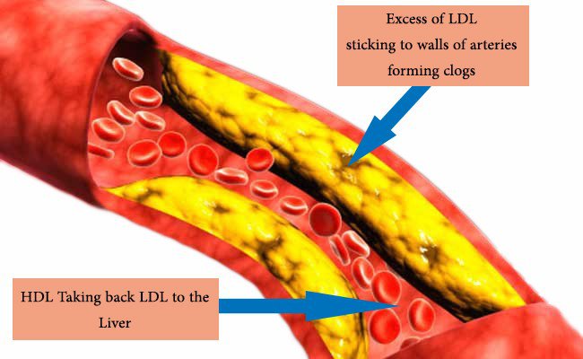 Sự khác nhau giữa LDL cholesterol và HDL cholesterol - Ảnh 1.