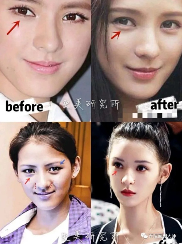 Sao nữ Trung Quốc đẹp nhờ phẫu thuật thẩm mỹ - Ảnh 2.