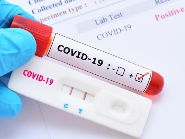 Xét nghiệm PCR COVID-19: Chỉ số Ct càng cao càng khó lây nhiễm - Ảnh 1.