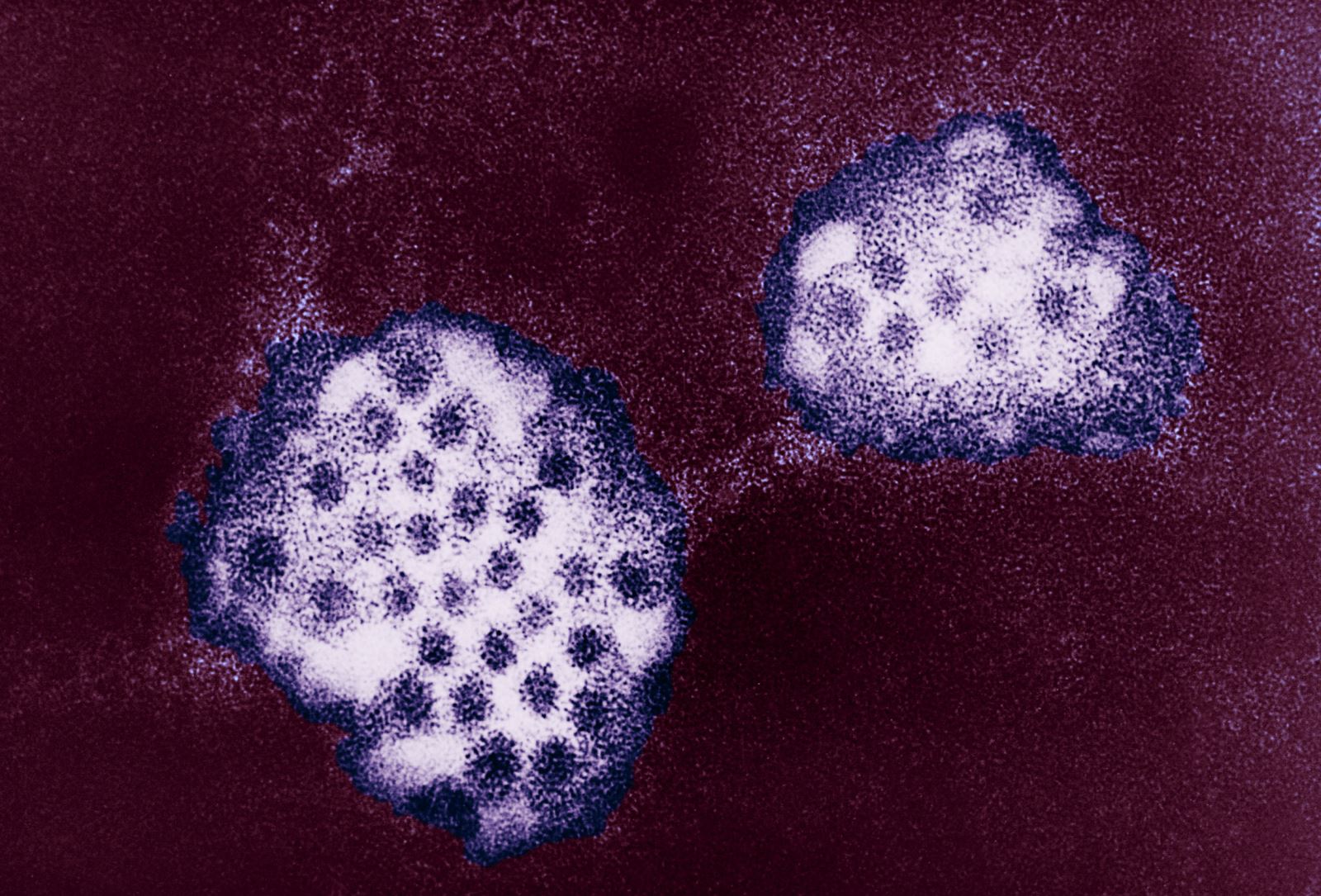 Dịch cúm dạ dày bùng phát tại Mỹ sau làn sóng COVID-19 - Ảnh 1.