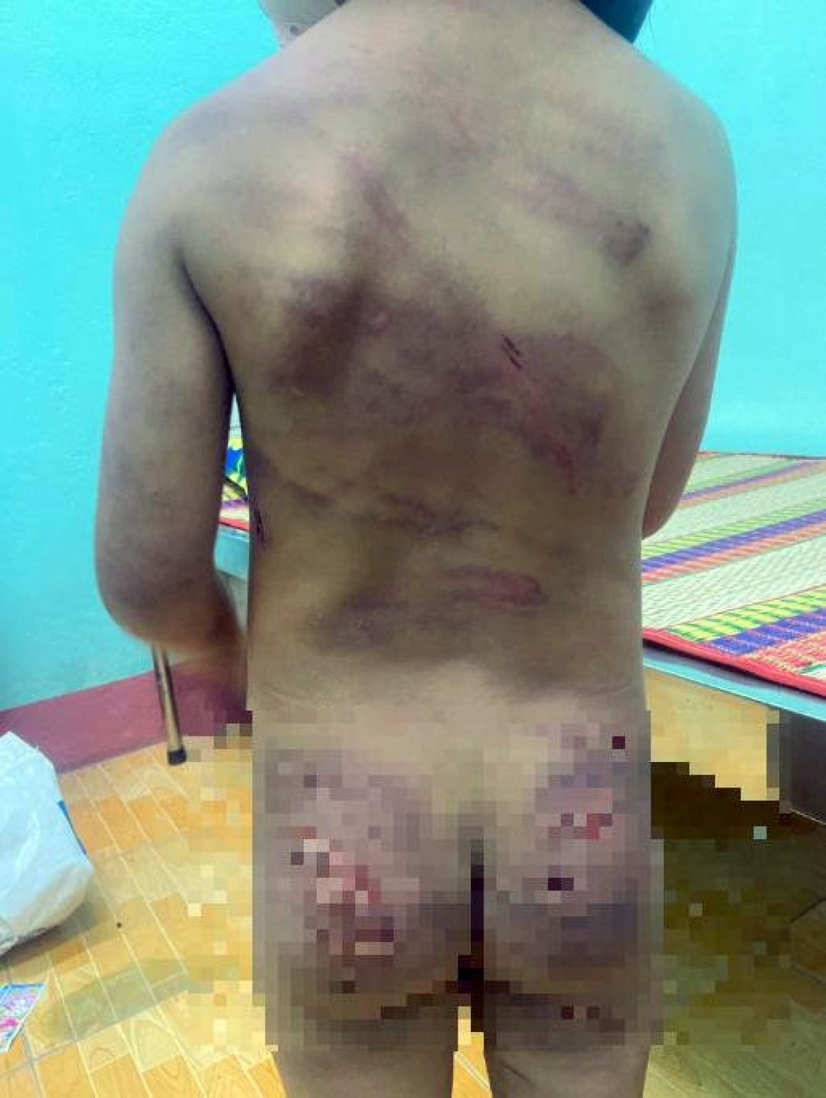 Bé 7 tuổi nghi bị bạo hành ở Bình Phước đã được đưa đi điều trị - Ảnh 1.