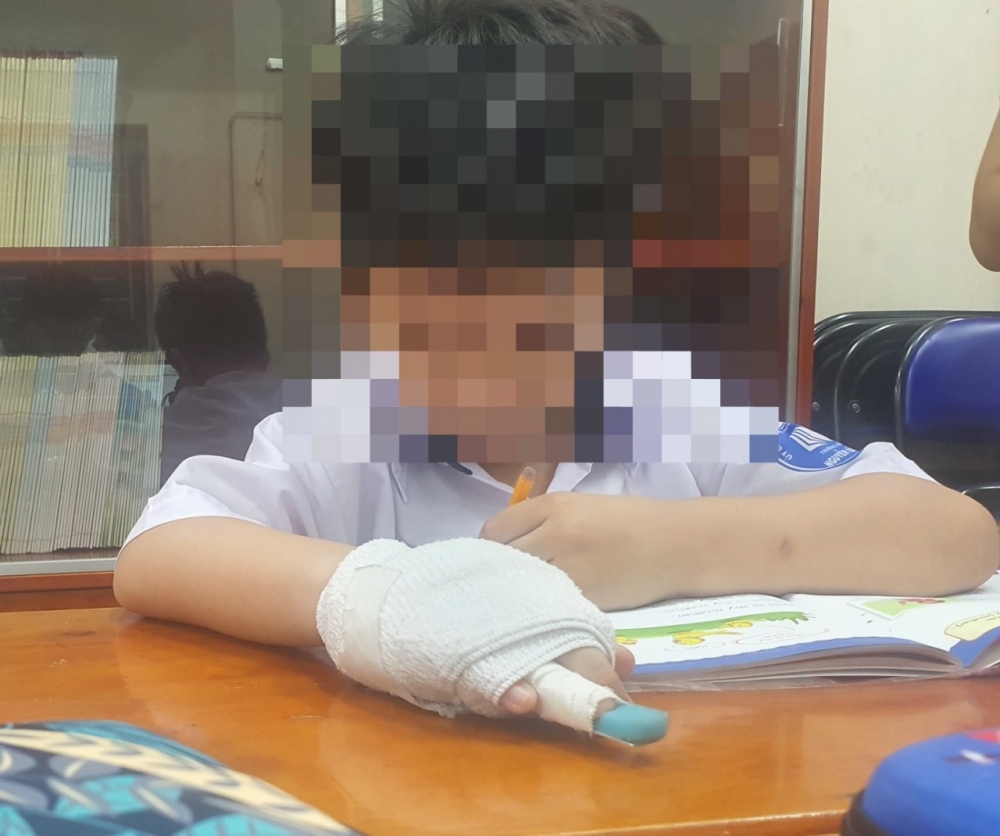 Tạm đình chỉ đối với giáo viên nghi làm gãy ngón tay học sinh tiểu học ở TP.HCM - Ảnh 1.