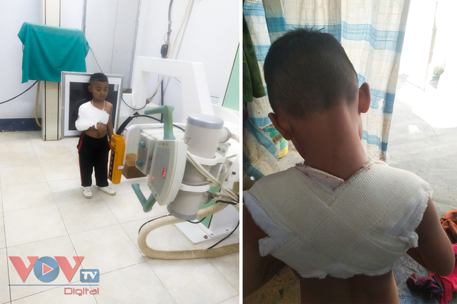 Sơn La: Cần làm rõ việc bé trai 4 tuổi bị gãy xương đòn tay phải khi rời trường về nhà - Ảnh 3.