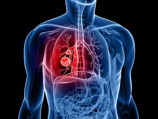  Thanh lọc phổi bằng phương pháp tự nhiên - Ảnh 1.