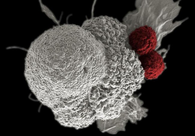 Sự khác biệt giữa tế bào ung thư và tế bào bình thường - Ảnh 1.
