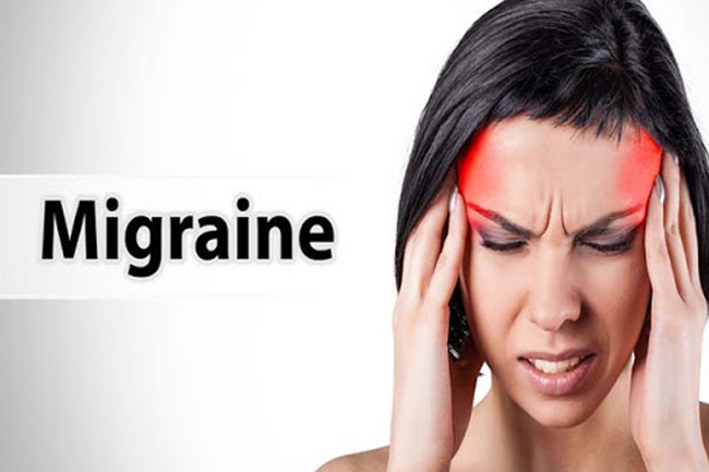 Đau đầu Migrain một bệnh lý không hề đơn giản - Ảnh 3.