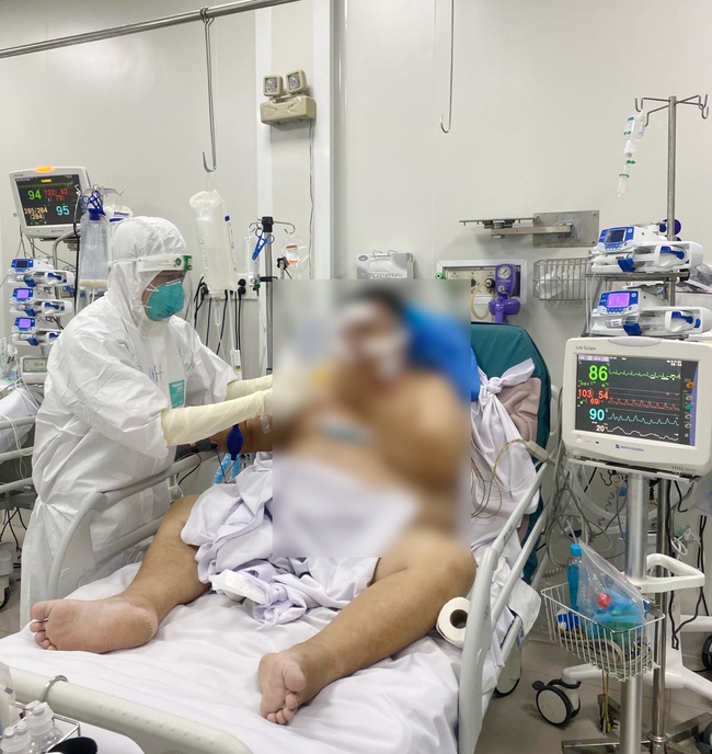 Bệnh viện Chợ Rẫy cứu sống 2 bệnh nhân Covid-19 nguy kịch - Ảnh 1.