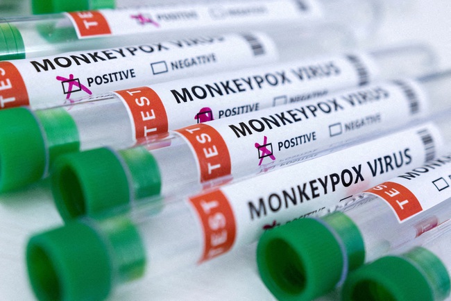 Bộ Y tế thông tin về bệnh nhân đầu tiên mắc bệnh đậu mùa khỉ tại Việt Nam - Ảnh 1.