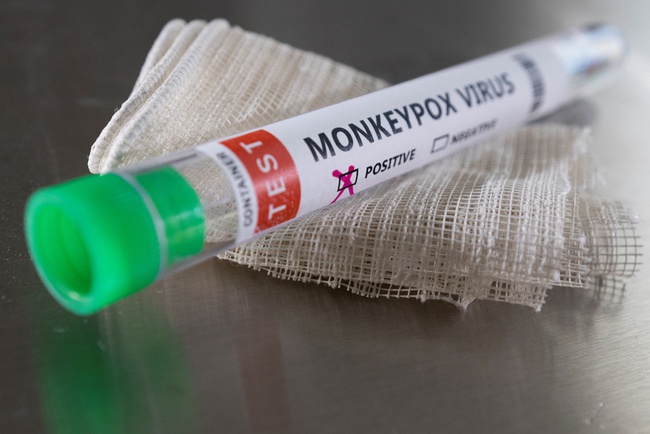WHO: Bệnh đậu mùa khỉ vẫn tiếp tục lây lan trên thế giới - Ảnh 1.
