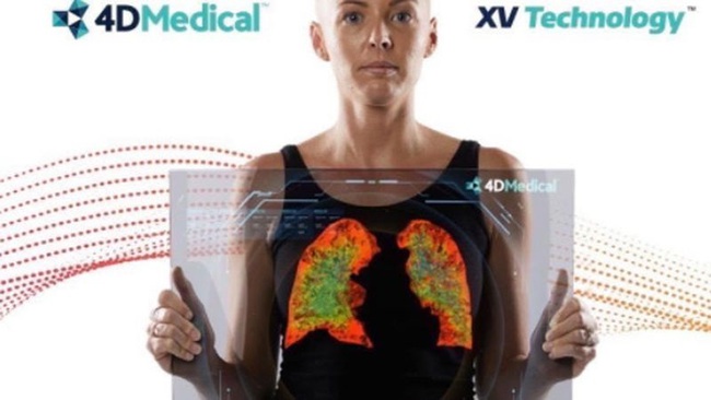 Australia trang bị thiết bị chụp phổi 4D đầu tiên trên thế giới - Ảnh 2.
