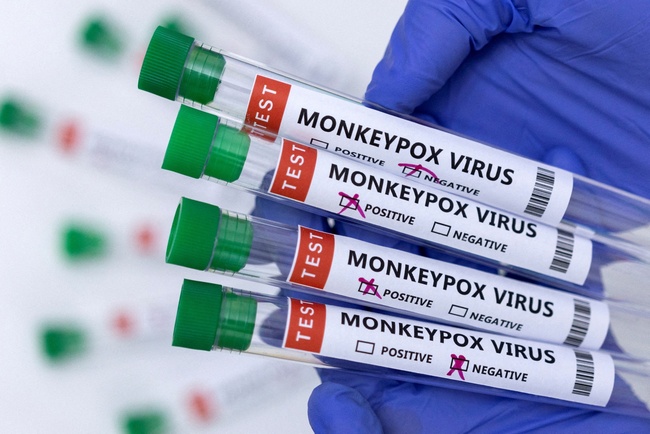 CDC Mỹ nâng mức cảnh báo với bệnh đậu mùa khỉ - Ảnh 1.