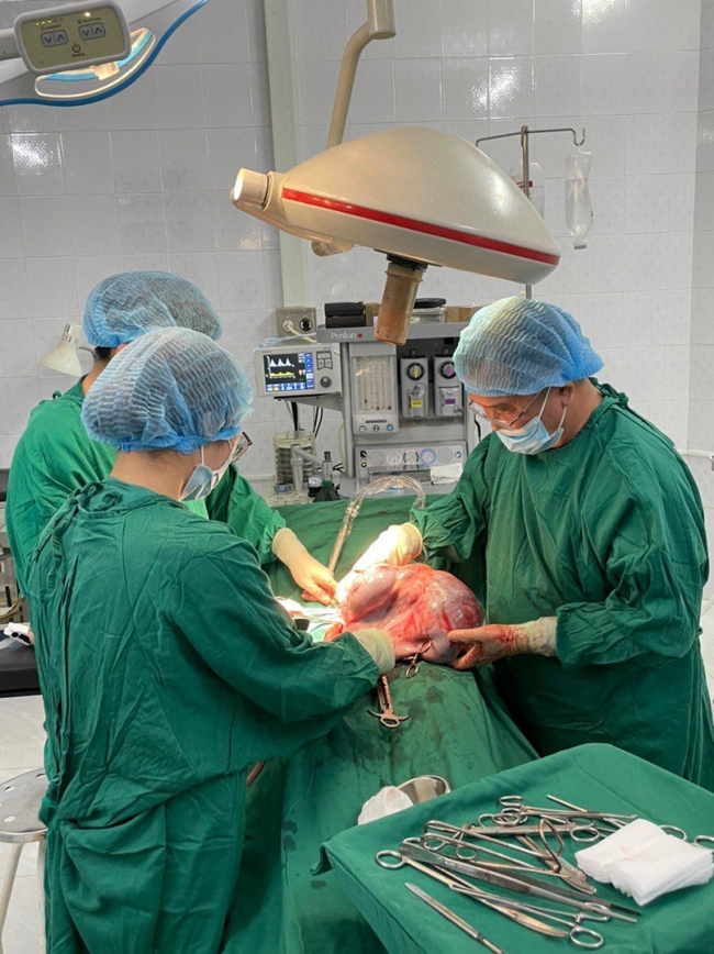 Đắk Lắk: Bệnh viện tuyến huyện phẫu thuật thành công cắt khối u buồng trứng nặng 10kg - Ảnh 1.