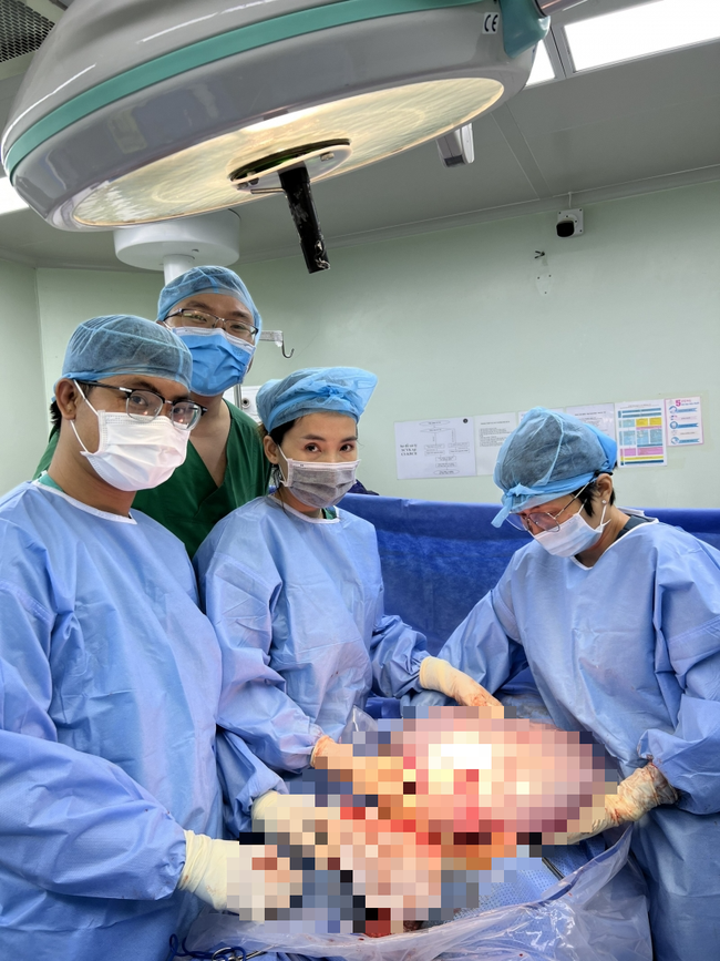 Cần Thơ: Vừa phẫu thuật lấy thai, vừa cắt trọn khối u nang buồng trứng 'khổng lồ' - Ảnh 1.