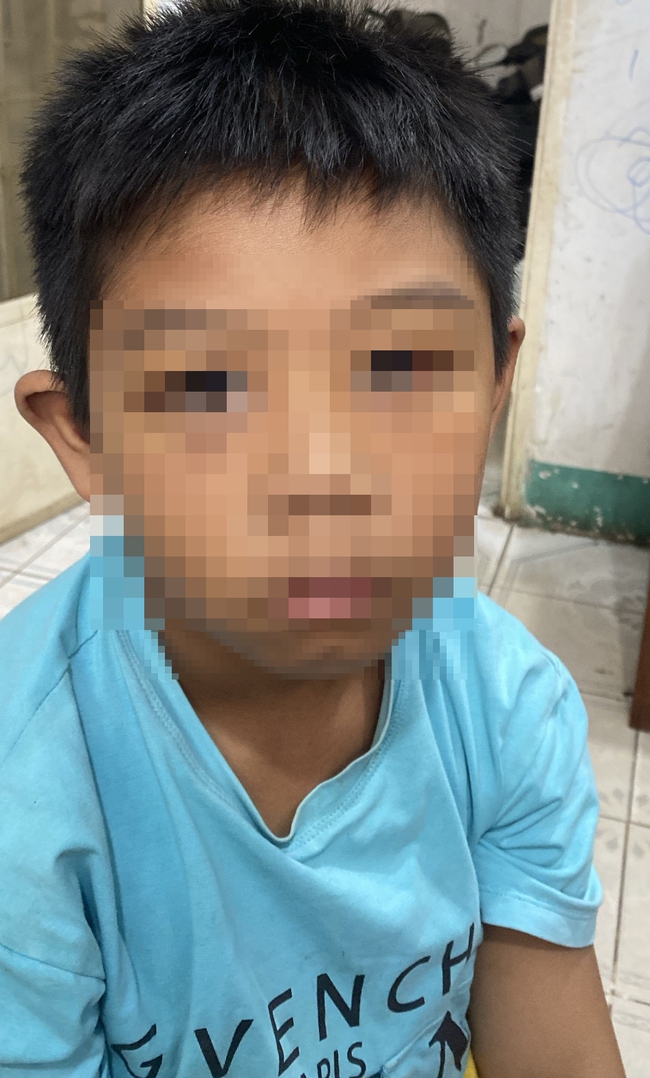 Bắt khẩn cấp cha dượng bạo hành bé trai ở Bình Phước- Ảnh 2.