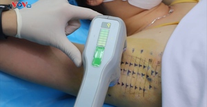 Hôi nách mùa đông có thể điều trị khỏi hay không? 