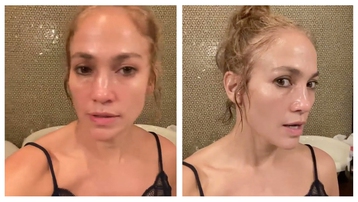 Jennifer Lopez bị tố tiêm botox đến đơ cả mặt
