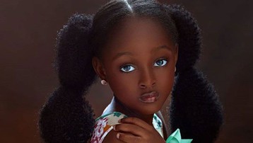 Cô bé châu Phi đẹp nhất thế giới thay đổi sau 2 năm, nhìn mẹ mới hiểu: Là di truyền