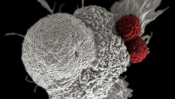 Sự khác biệt giữa tế bào ung thư và tế bào bình thường