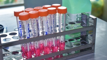 Cần biết: 16 loại test nhanh SARS-CoV-2 được Bộ Y tế cấp phép