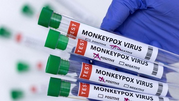 CDC Mỹ nâng mức cảnh báo với bệnh đậu mùa khỉ