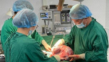 Đắk Lắk: Bệnh viện tuyến huyện phẫu thuật thành công cắt khối u buồng trứng nặng 10kg