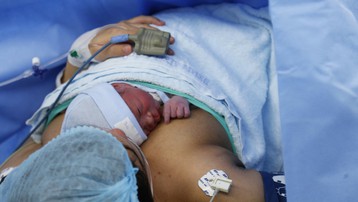 Em bé đầu tiên được thông tim xuyên bào thai đã chào đời