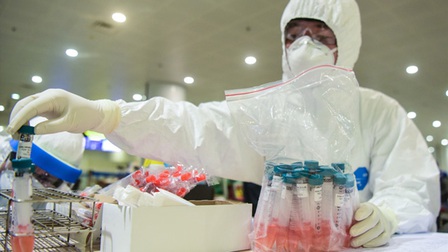 TPHCM: Hơn 700 mẫu xét nghiệm có kết quả âm tính với SARS-CoV-2