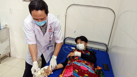 Đắk Lắk: Nhiều trường hợp thương tích nặng do tai nạn pháo nổ