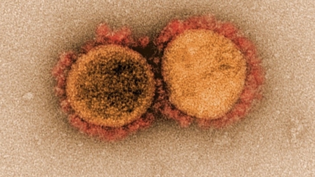 Kịch bản ác mộng về tác động của biến chủng virus mới phát hiện ở California