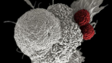 Sự khác biệt giữa tế bào ung thư và tế bào bình thường