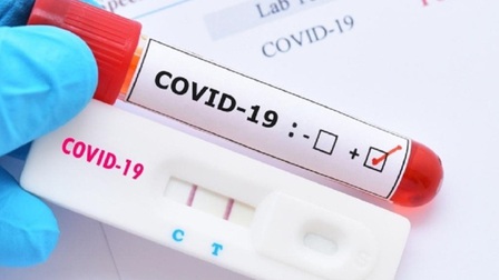 Xét nghiệm PCR COVID-19: Chỉ số Ct càng cao càng khó lây nhiễm