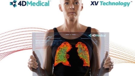 Australia trang bị thiết bị chụp phổi 4D đầu tiên trên thế giới