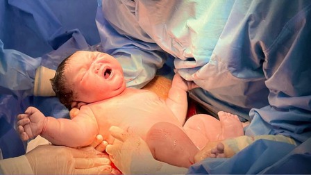 Bé sơ sinh nặng gần 6kg chào đời tại Bệnh viện Hùng Vương
