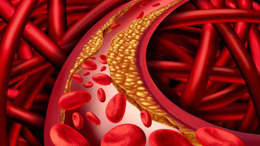 Những điều cần biết về Cholesterol