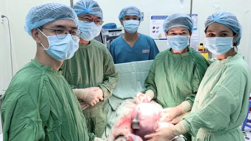 Cần Thơ: Phẫu thuật cứu sống sản phụ tiền sản giật nặng do u nang buồng trứng khổng lồ