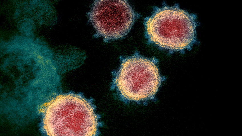 Nguy cơ xuất hiện những biến thể nguy hiểm mới của virus SARS-CoV-2