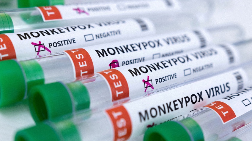 Bộ Y tế thông tin về bệnh nhân đầu tiên mắc bệnh đậu mùa khỉ tại Việt Nam